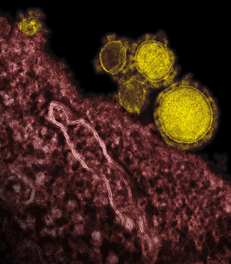 Illustration for article titled Psychedelic Images of Terrifying Viruses